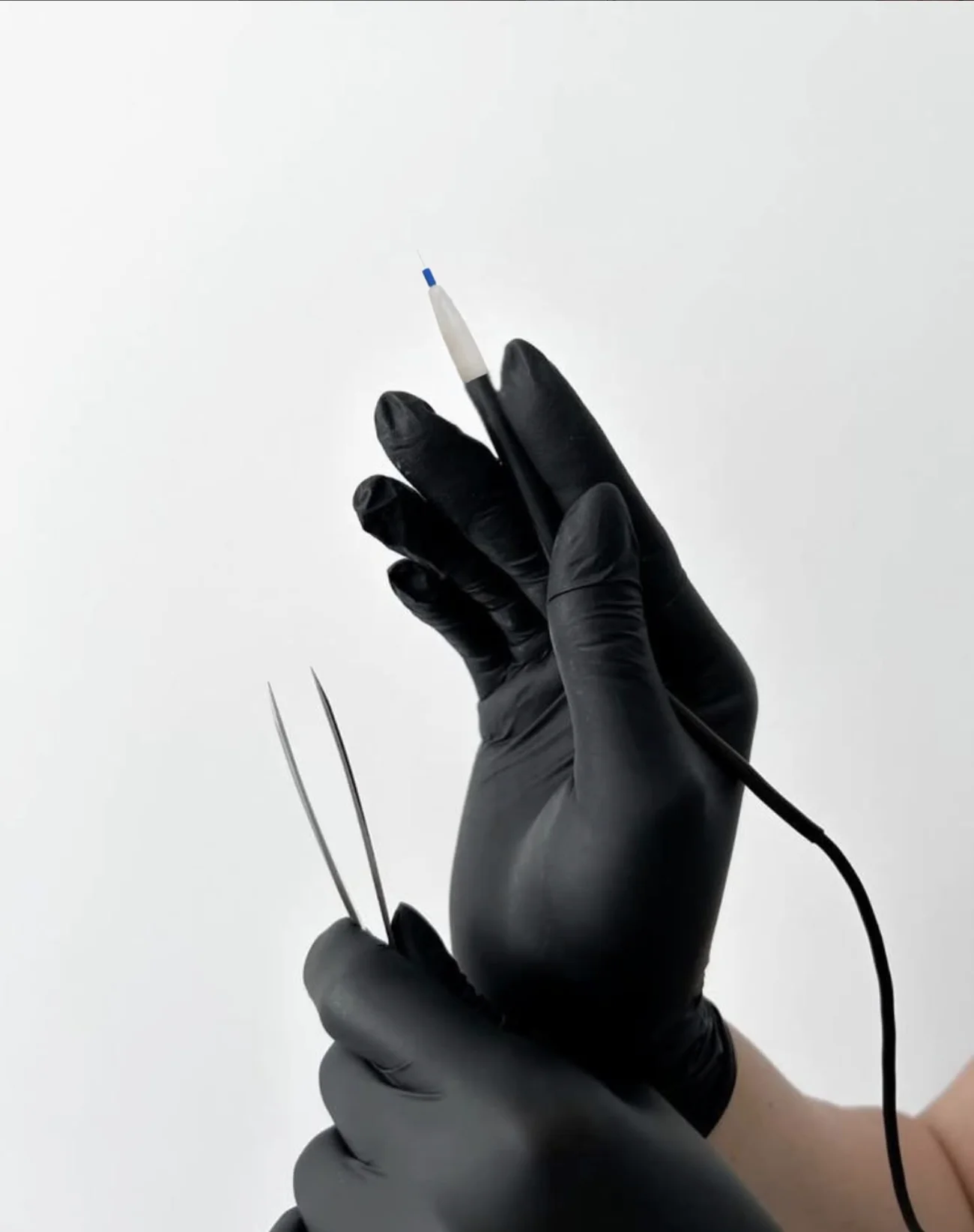 Micro-filament Apilus introduit dans le follicule